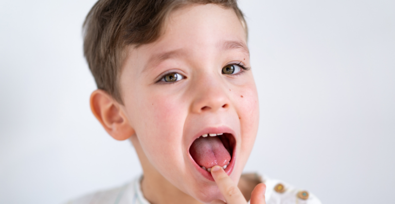 6 Mitos y realidades de los dientes de leche