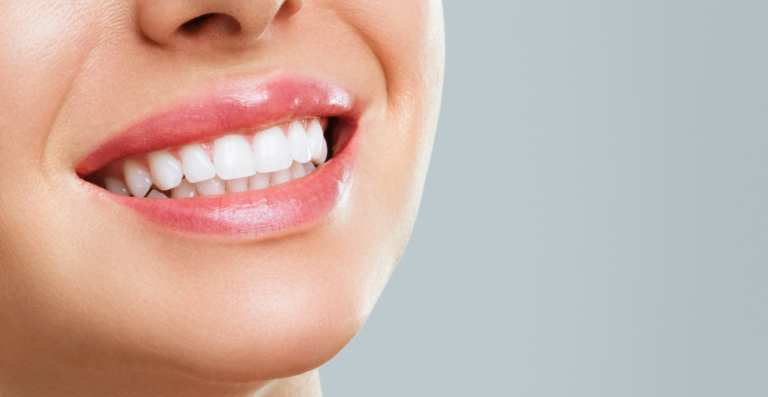Sonrisa Perfecta: Tratamientos de blanqueamiento dental